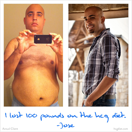 Jose Before and After Doing the HCG Triumph Diet