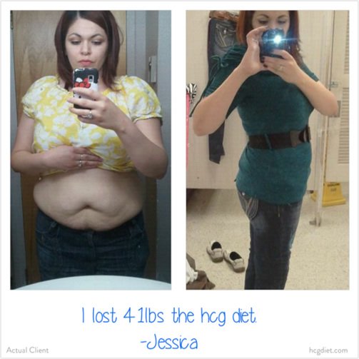 See what HCG Triumph did to Jessica!